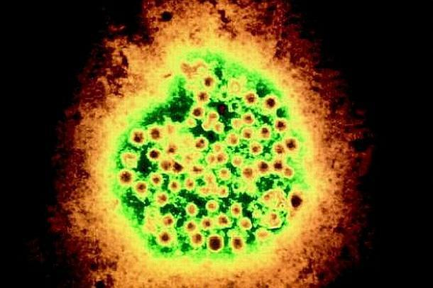 hepatit